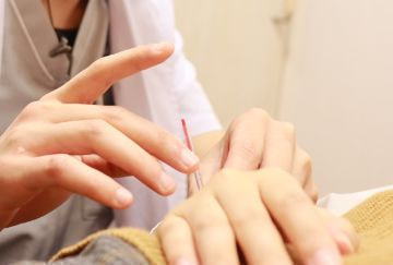 醒脳開竅法